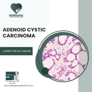 Adenoid cystic carcinoma