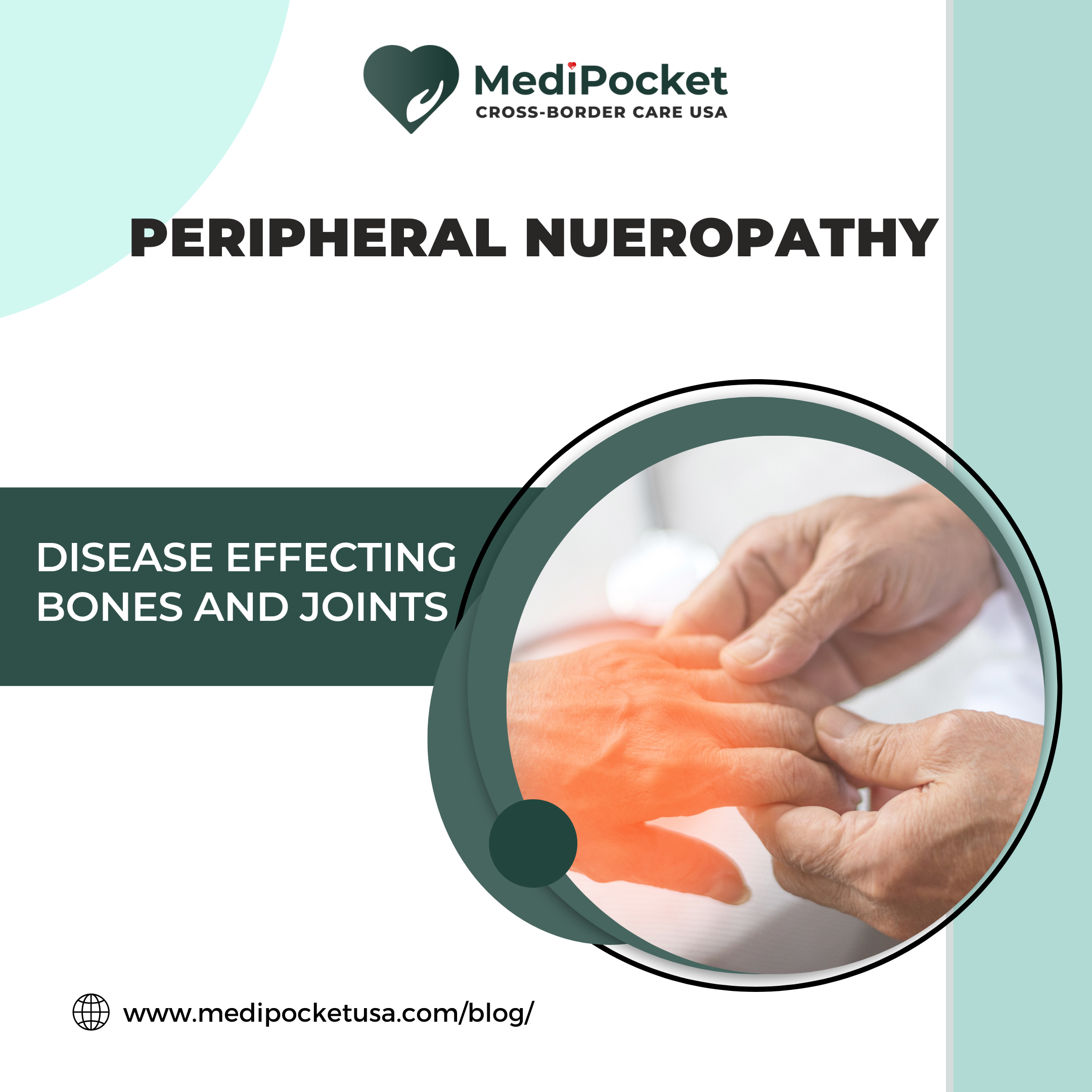 peripheral Nueropathy