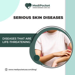 serious skin diseases - MediPocket USA