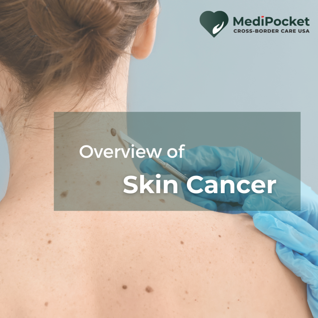 Skin Cancer & Treatment