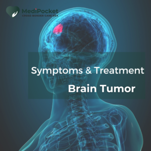 Brain tumor - Symptoms and Treatment