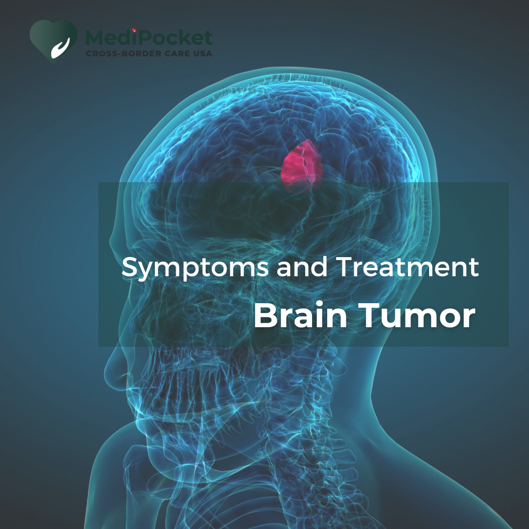 Brain tumor: Symptoms and Treatment