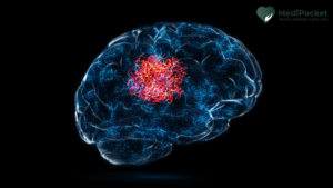 Brain tumor - Symptoms and treatment