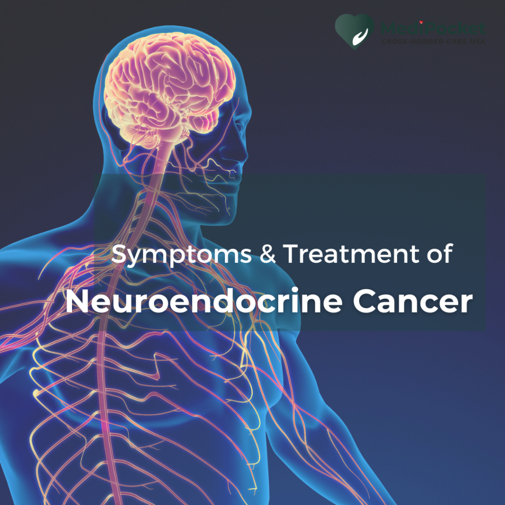 What is Neuroendocrine Cancer? Symptoms and Treatment