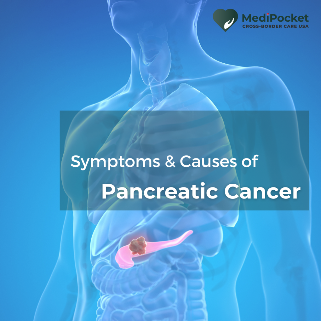 Pancreatic Cancer. Causes and Symptoms.