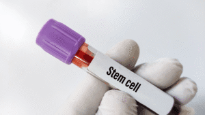 Stem cell therapy